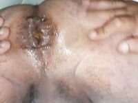 Grosse melanzane per via anale